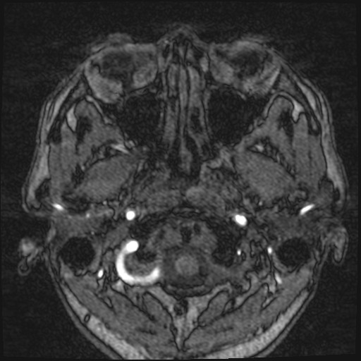 Click on the Serie image to view the images of VILLANUEVA, WILLIAM A.